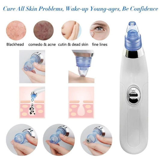 Rechargeable Blackhead Remover Vacuum Pore Cleaner